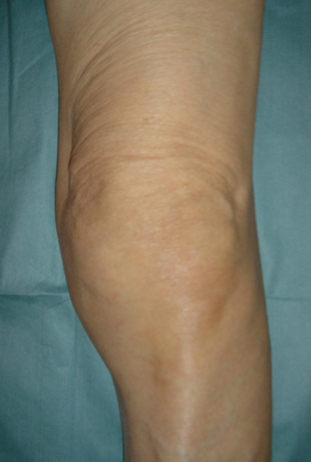 膝関節外科学 南江堂 膝関節外科学 The Knee 膝関節外科学 The Knee 膝関節外科学: 書籍／南江堂